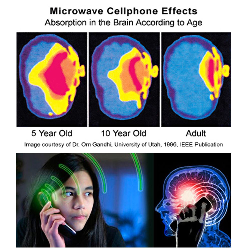 PERIGO radiacao de celular em criancas