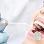 Saiba que procedimentos podem ser feitos no consultório através da Cirurgia Oral Menor