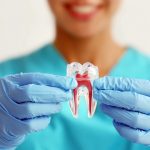 O que um especialista em endodontia faz?