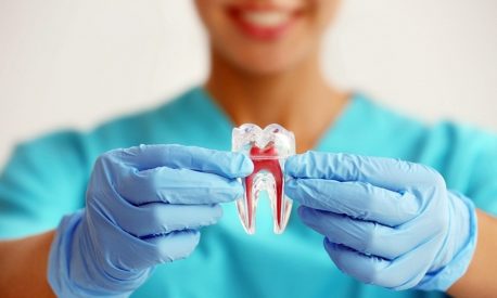 O que um especialista em endodontia faz?