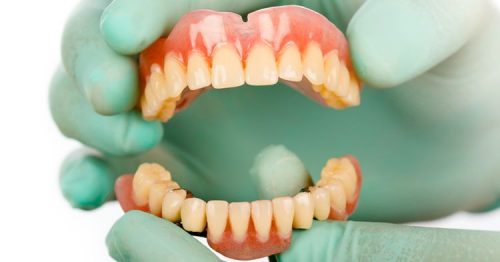 Guia das próteses dentárias: você sabe qual é a melhor para você?